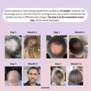 Glowwa Hair Suuplements Results Zappas Salons